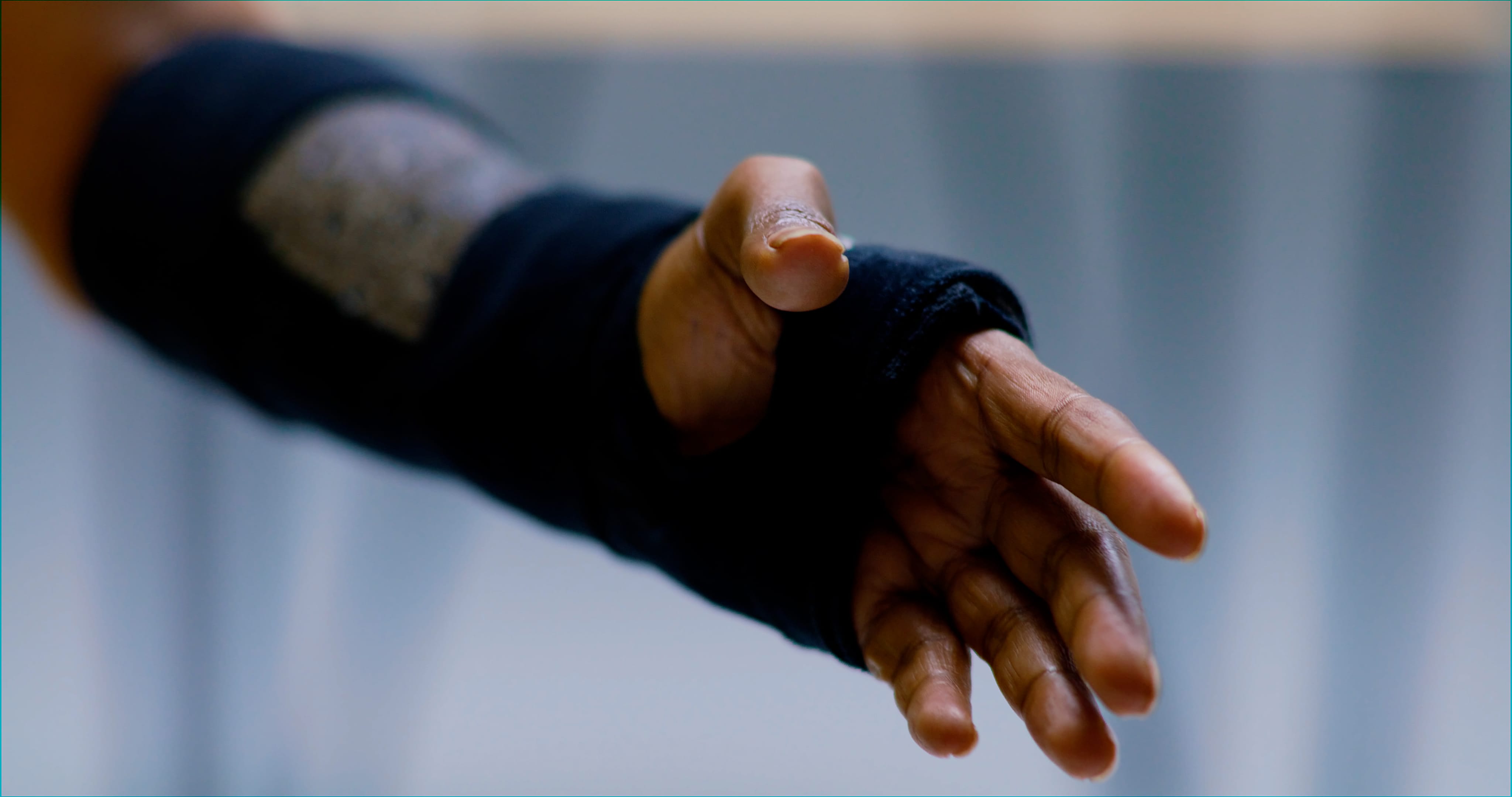 Trial on scaphoid fractures provides practicechanging evidence "If